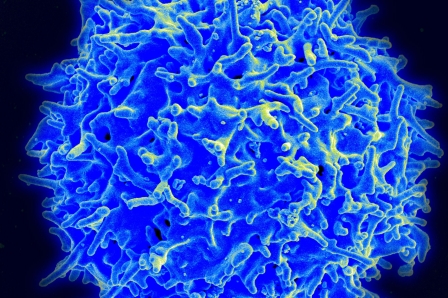 Healthy human T cell (via NIAID) - FDA Lets Juno Jump Back Into T-Cell Trial, Minus One Chemo Drug