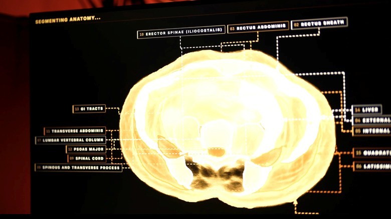 Midjourney, the AI image generator, is developing a full-body ultrasonic scanner | DeviceDaily.com